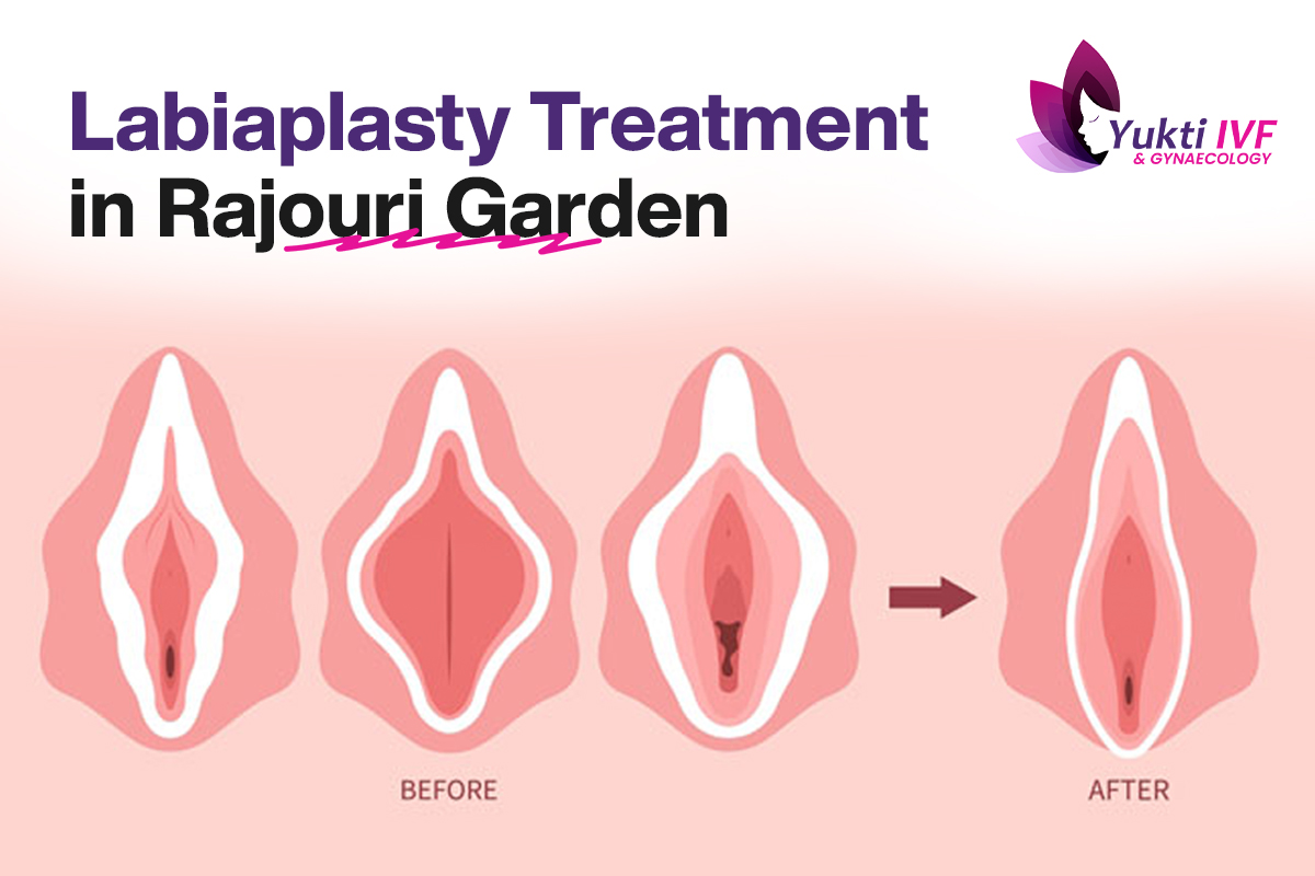 Labiaplasty treatment in Rajorui Garden