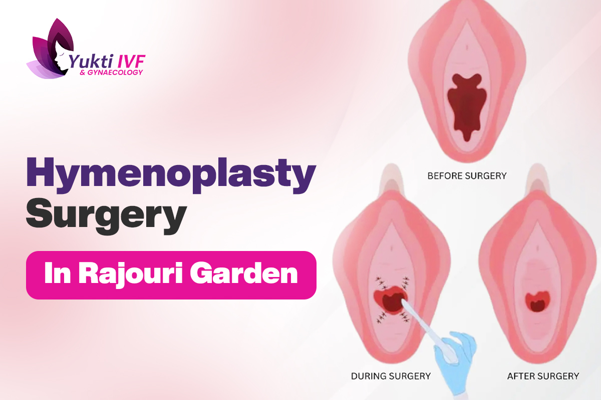 Hymenoplasty Surgery in Rajouri Garden