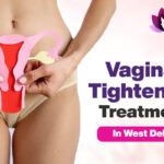 vaginal tightening treatment in west delhi